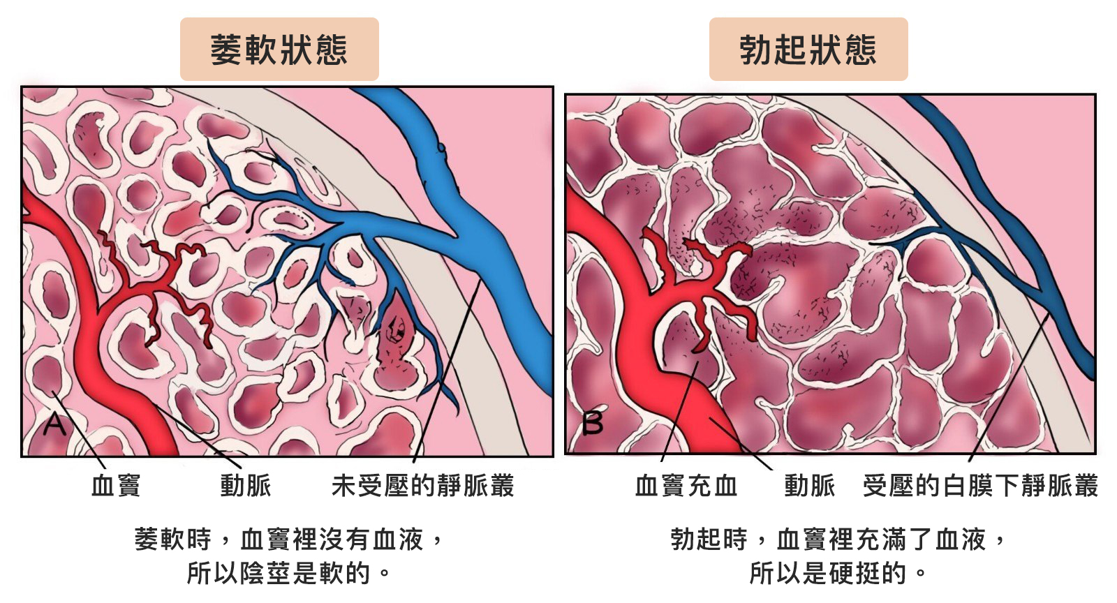 勃起功能障礙