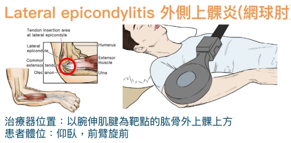 動磁波30