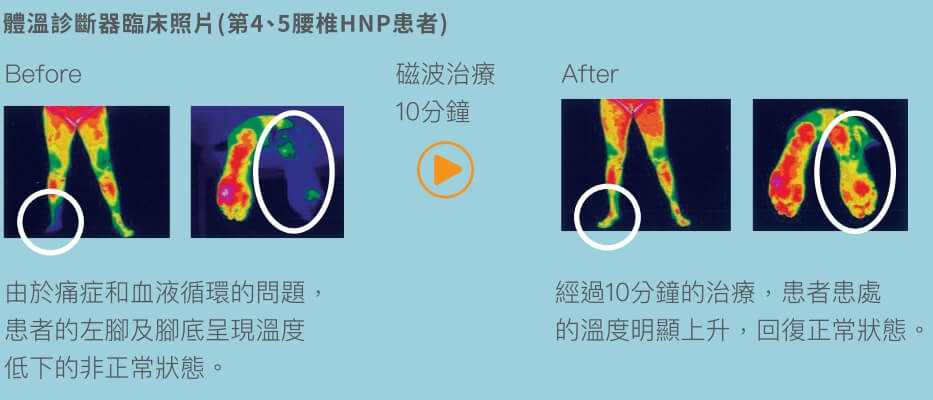 動磁波30