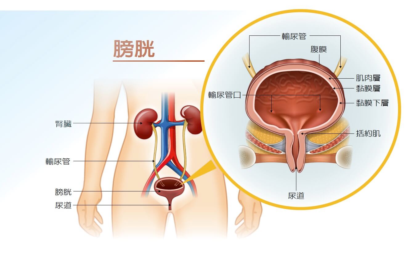 尿失禁漏尿