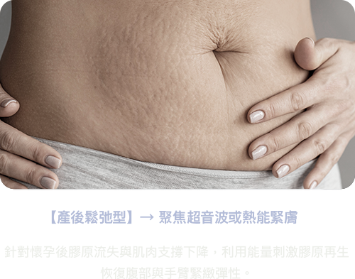 產後鬆弛型 聚焦超音波 熱能緊膚