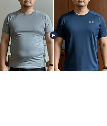 男性啤酒肚 悠美體雕療程