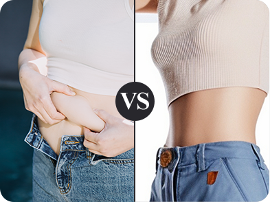 減少脂肪量 精準剷平頑固脂肪:告別小腹婆、馬鞍肉