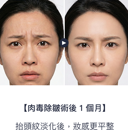 抬頭紋淡化後，妝感更平整