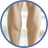 小腿肌太明顯，腿看起來又硬又壯？