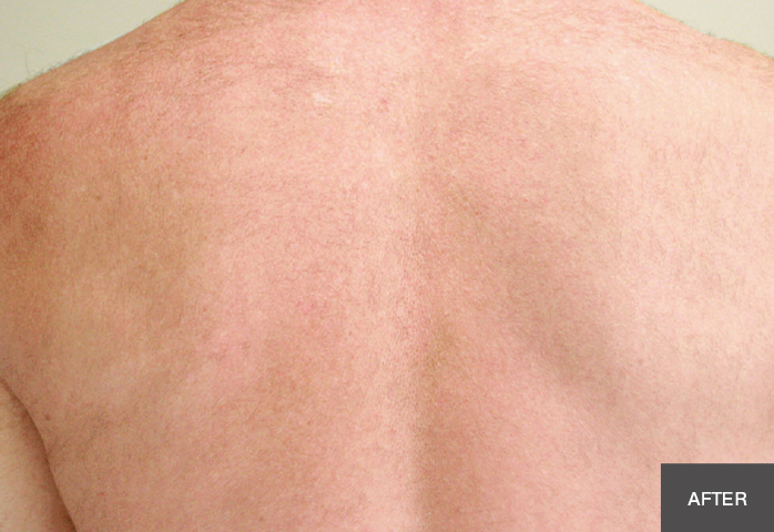 After Image