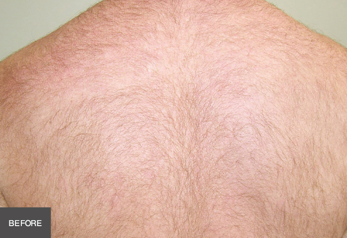 Before Image