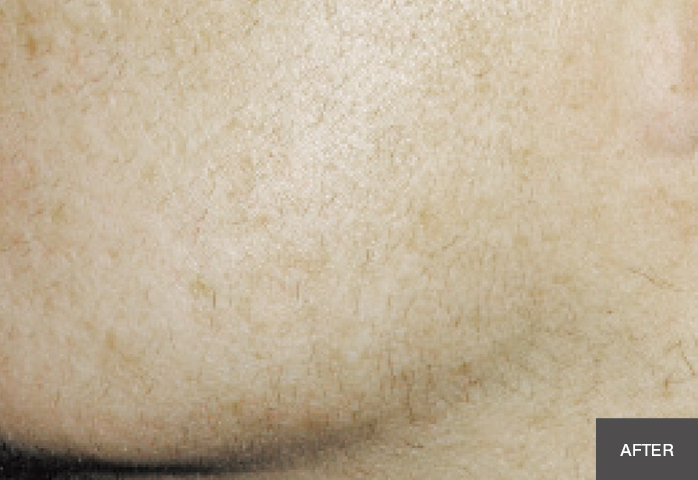 After Image
