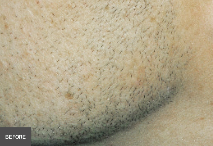 Before Image