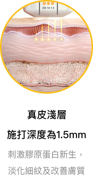 真皮淺層 施打深度為1.5mm 刺激膠原蛋白新生 淡化細紋及改善膚質