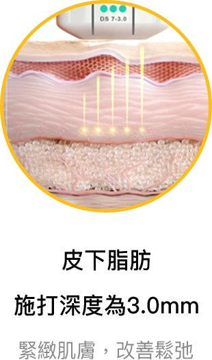 皮下脂肪 施打深度為3.0mm 緊緻肌膚,改善鬆弛