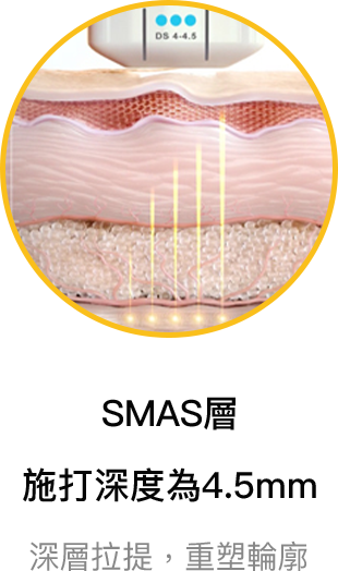 SMAS層 施打深度為4.5mm 深層拉提,重塑輪廓