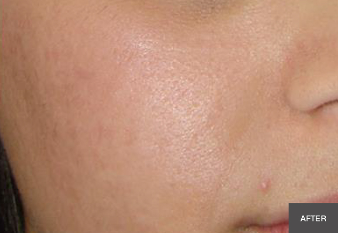 After Image