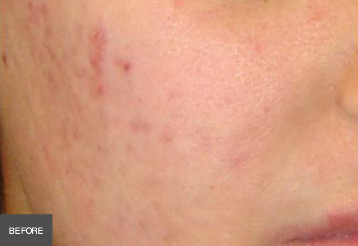 Before Image