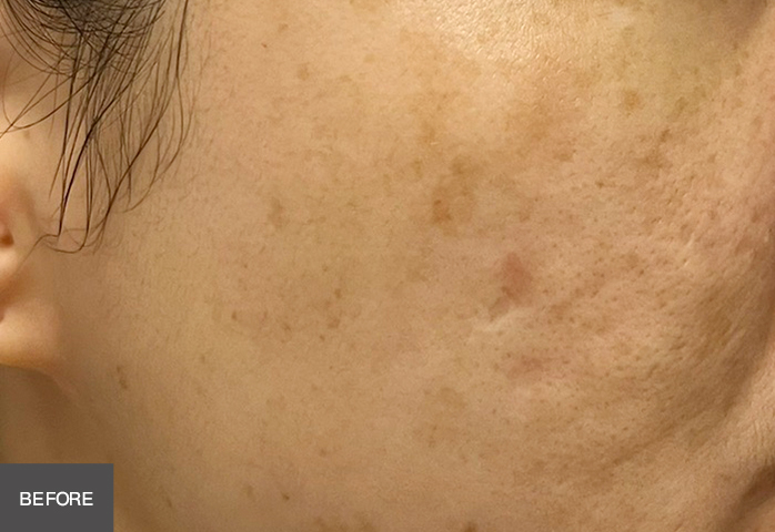 Before Image