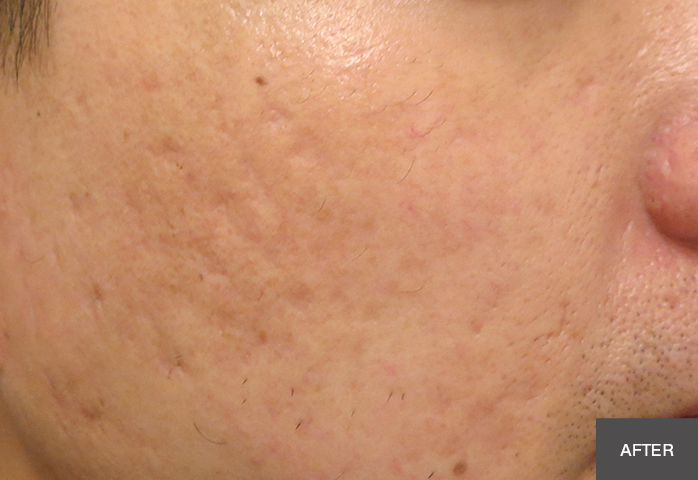 After Image