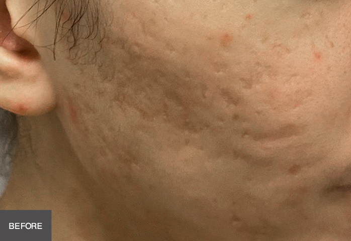 Before Image